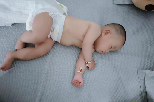 吐鲁番孕妇前庭大腺囊肿